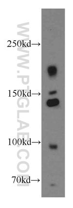 INSR Antibody in Western Blot (WB)