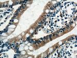 GLUT2 Antibody in Immunohistochemistry (Paraffin) (IHC (P))