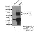 GLUT2 Antibody in Immunoprecipitation (IP)