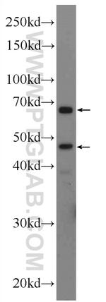 GLUT2 Antibody in Western Blot (WB)