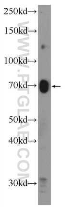 GLUT2 Antibody in Western Blot (WB)