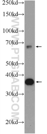 GLUT2 Antibody in Western Blot (WB)