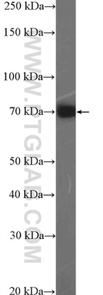 RNF6 Antibody in Western Blot (WB)