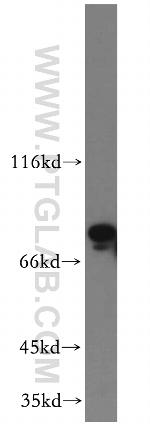 RNF6 Antibody in Western Blot (WB)