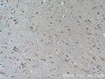 EDG2 Antibody in Immunohistochemistry (Paraffin) (IHC (P))