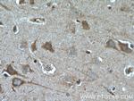 EDG2 Antibody in Immunohistochemistry (Paraffin) (IHC (P))