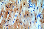 SMN Antibody in Immunohistochemistry (Paraffin) (IHC (P))