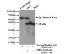 SMN Antibody in Immunoprecipitation (IP)