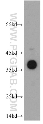 SMN Antibody in Western Blot (WB)