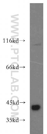 SMN Antibody in Western Blot (WB)