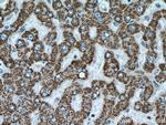 ALDH6A1 Antibody in Immunohistochemistry (Paraffin) (IHC (P))