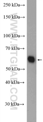 ALDH6A1 Antibody in Western Blot (WB)