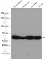 ALDH6A1 Antibody in Western Blot (WB)