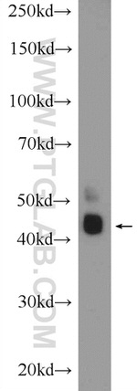 RAPSN Antibody in Western Blot (WB)