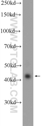 RAPSN Antibody in Western Blot (WB)