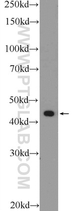 RAPSN Antibody in Western Blot (WB)