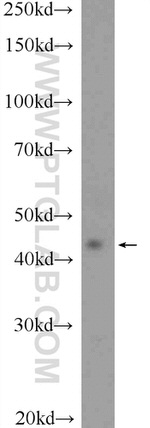 RAPSN Antibody in Western Blot (WB)