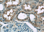 ZIP8 Antibody in Immunohistochemistry (Paraffin) (IHC (P))