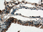 ZIP8 Antibody in Immunohistochemistry (Paraffin) (IHC (P))