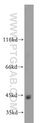 ZIP8 Antibody in Western Blot (WB)