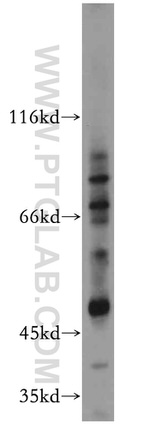 ZIP8 Antibody in Western Blot (WB)