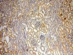 INF2 Antibody in Immunohistochemistry (Paraffin) (IHC (P))