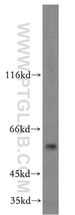 C9orf156 Antibody in Western Blot (WB)