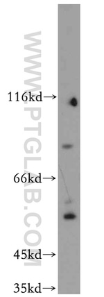 C9orf156 Antibody in Western Blot (WB)