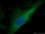 TBC1D17 Antibody in Immunocytochemistry (ICC/IF)