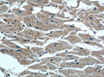 TBC1D17 Antibody in Immunohistochemistry (Paraffin) (IHC (P))