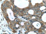 TBC1D17 Antibody in Immunohistochemistry (Paraffin) (IHC (P))