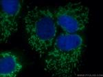 DAXX Antibody in Immunocytochemistry (ICC/IF)