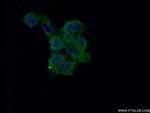 NME2 Antibody in Immunocytochemistry (ICC/IF)