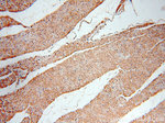 NME2 Antibody in Immunohistochemistry (Paraffin) (IHC (P))