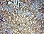 NME2 Antibody in Immunohistochemistry (Paraffin) (IHC (P))