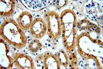 NME2 Antibody in Immunohistochemistry (Paraffin) (IHC (P))