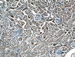 NME2 Antibody in Immunohistochemistry (Paraffin) (IHC (P))