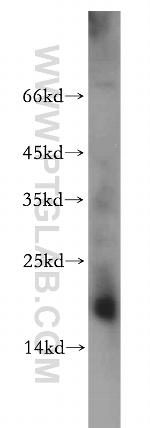 NME2 Antibody in Western Blot (WB)