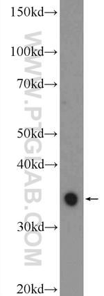 ABHD6 Antibody in Western Blot (WB)