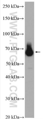 SLC11A2 Antibody in Western Blot (WB)