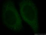 WDR6 Antibody in Immunocytochemistry (ICC/IF)