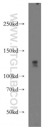 WDR6 Antibody in Western Blot (WB)