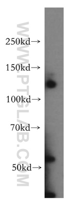 WDR6 Antibody in Western Blot (WB)