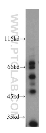 WIPF2 Antibody in Western Blot (WB)