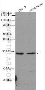 BTG4 Antibody in Western Blot (WB)