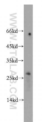 BTG4 Antibody in Western Blot (WB)