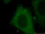 IL20RB Antibody in Immunocytochemistry (ICC/IF)