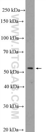 DDX49 Antibody in Western Blot (WB)