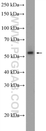 DDX49 Antibody in Western Blot (WB)