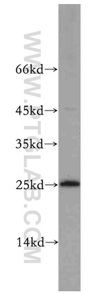 EIF1AD Antibody in Western Blot (WB)